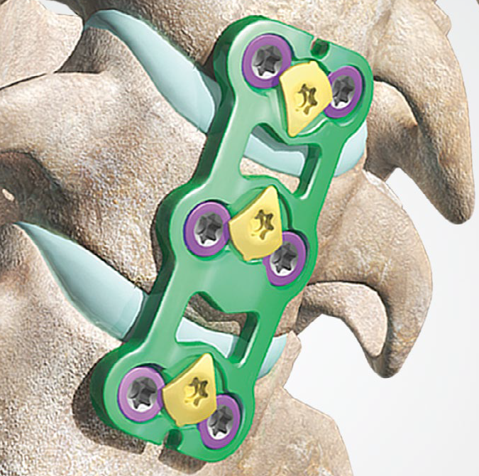 M6-C ARTIFICIAL CERVICAL DISC TWO-LEVEL IDE CLINICAL STUDY